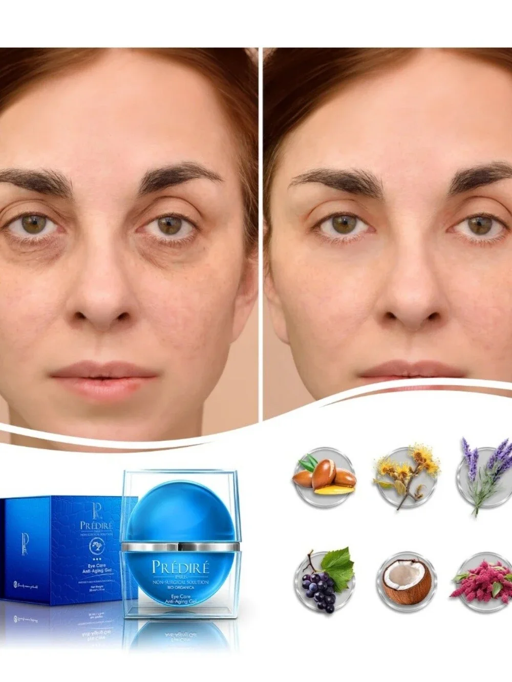 Predire anti aging